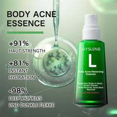 Acne Spot Lightening Serum for Skin Care