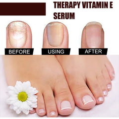 Oceaura Nail Repair Essence for Healthy Nails