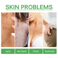 Acne Spot Lightening Serum for Skin Care