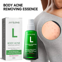 Acne Spot Lightening Serum for Skin Care